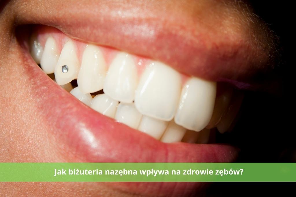 Jak biżuteria nazębna wpływa na zdrowie zębów